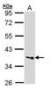 Palmitoyl-Protein Thioesterase 1 antibody, PA5-29177, Invitrogen Antibodies, Western Blot image 