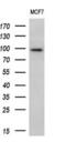 Epithelial Cell Transforming 2 antibody, M01862-1, Boster Biological Technology, Western Blot image 