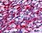 Fms Related Tyrosine Kinase 3 antibody, 48-319, ProSci, Immunohistochemistry frozen image 