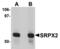 Sushi Repeat Containing Protein X-Linked 2 antibody, TA306870, Origene, Western Blot image 
