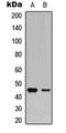 Vasodilator Stimulated Phosphoprotein antibody, LS-C358886, Lifespan Biosciences, Western Blot image 