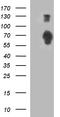 Signal Regulatory Protein Alpha antibody, TA507320, Origene, Western Blot image 