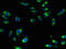 Sodium/glucose cotransporter 5 antibody, LS-C396641, Lifespan Biosciences, Immunofluorescence image 
