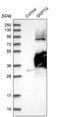 N-Acetylglucosamine-1-Phosphate Transferase Subunit Gamma antibody, PA5-52045, Invitrogen Antibodies, Western Blot image 