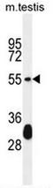 Keratin 33A antibody, AP52429PU-N, Origene, Western Blot image 