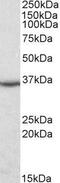 Dimethylarginine Dimethylaminohydrolase 1 antibody, GTX89709, GeneTex, Western Blot image 