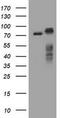 Receptor Interacting Serine/Threonine Kinase 1 antibody, TA800357, Origene, Western Blot image 
