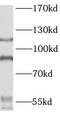 Poly(ADP-Ribose) Polymerase 1 antibody, FNab06152, FineTest, Western Blot image 