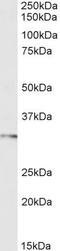 Forkhead Box I1 antibody, GTX03671, GeneTex, Western Blot image 