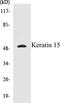 Keratin 15 antibody, EKC1321, Boster Biological Technology, Western Blot image 