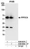 Serine/threonine-protein phosphatase 2B catalytic subunit alpha isoform antibody, A300-908A, Bethyl Labs, Immunoprecipitation image 