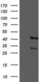 Tropomodulin 1 antibody, NBP2-00955, Novus Biologicals, Western Blot image 