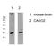 Cyclin C antibody, STJ99629, St John
