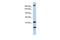 Protein dispatched homolog 1 antibody, PA5-43505, Invitrogen Antibodies, Western Blot image 