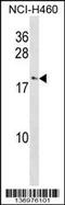 C-C Motif Chemokine Ligand 27 antibody, 58-929, ProSci, Western Blot image 