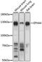 Ephrin type-A receptor 4 antibody, STJ110644, St John