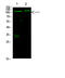 Forkhead Box O3 antibody, STJ98847, St John