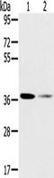 Survival Of Motor Neuron 2, Centromeric antibody, TA351729, Origene, Western Blot image 