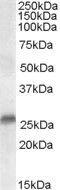 Steroid 5 Alpha-Reductase 2 antibody, GTX89611, GeneTex, Western Blot image 