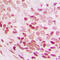 Nei Like DNA Glycosylase 3 antibody, GTX55960, GeneTex, Immunohistochemistry paraffin image 