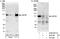 Ubiquitin Specific Peptidase 38 antibody, A300-941A, Bethyl Labs, Immunoprecipitation image 