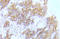Fms Related Tyrosine Kinase 3 antibody, AP20941PU-N, Origene, Immunohistochemistry paraffin image 