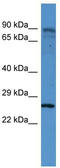 Clathrin Light Chain B antibody, TA342808, Origene, Western Blot image 