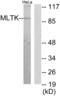 Mitogen-Activated Protein Kinase Kinase Kinase 20 antibody, abx013817, Abbexa, Western Blot image 