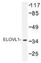 ELOVL Fatty Acid Elongase 1 antibody, AP01399PU-N, Origene, Western Blot image 