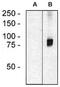 Rho Guanine Nucleotide Exchange Factor 4 antibody, AM26710PU-N, Origene, Western Blot image 