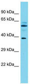 Mono-ADP Ribosylhydrolase 1 antibody, TA331983, Origene, Western Blot image 