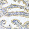 Oncostatin M antibody, abx006322, Abbexa, Western Blot image 