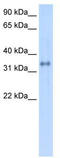 Carbonic Anhydrase 4 antibody, TA346048, Origene, Western Blot image 