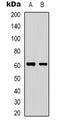YTH N6-Methyladenosine RNA Binding Protein 1 antibody, LS-C368844, Lifespan Biosciences, Western Blot image 