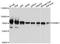 B Cell Scaffold Protein With Ankyrin Repeats 1 antibody, A05888, Boster Biological Technology, Western Blot image 