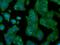 Ring Finger Protein 144B antibody, MA5-24997, Invitrogen Antibodies, Immunocytochemistry image 