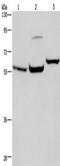 Estrogen Receptor 1 antibody, TA349938, Origene, Western Blot image 