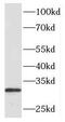 Paired Like Homeobox 2B antibody, FNab06408, FineTest, Western Blot image 