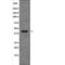 XPA, DNA Damage Recognition And Repair Factor antibody, PA5-64730, Invitrogen Antibodies, Western Blot image 