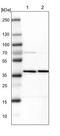 Protein Kinase AMP-Activated Non-Catalytic Subunit Beta 1 antibody, NBP1-87487, Novus Biologicals, Western Blot image 