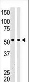BAI1 Associated Protein 2 antibody, LS-C100956, Lifespan Biosciences, Western Blot image 