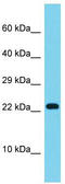 Distal Membrane Arm Assembly Complex 2 Like antibody, TA332335, Origene, Western Blot image 