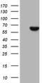 UDP-Glucose 6-Dehydrogenase antibody, M04764, Boster Biological Technology, Western Blot image 