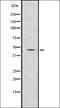 Renin antibody, orb336773, Biorbyt, Western Blot image 
