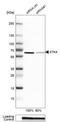 Serine/Threonine Kinase 4 antibody, NBP1-82865, Novus Biologicals, Western Blot image 