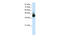 Cleavage stimulation factor subunit 3 antibody, 29-270, ProSci, Western Blot image 