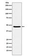 Dopamine Receptor D3 antibody, M01277, Boster Biological Technology, Western Blot image 