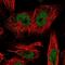 LDL Receptor Related Protein 5 Like antibody, PA5-55961, Invitrogen Antibodies, Immunofluorescence image 