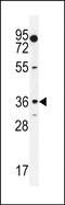 Monoacylglycerol O-Acyltransferase 1 antibody, PA5-71515, Invitrogen Antibodies, Western Blot image 