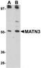 Matrilin 3 antibody, TA306762, Origene, Western Blot image 